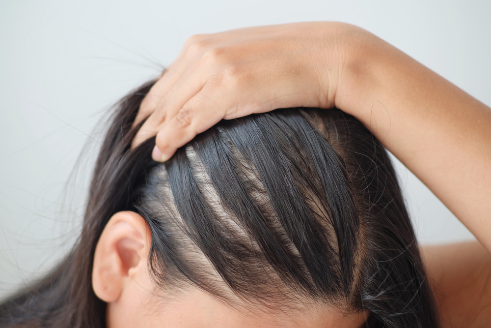 Best Hair Loss Salon Experts in Maryland