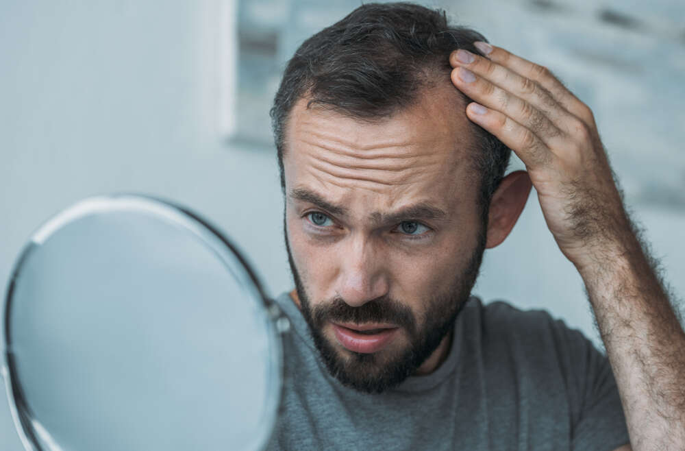 Best Hair Loss Results in Columbia, Maryland