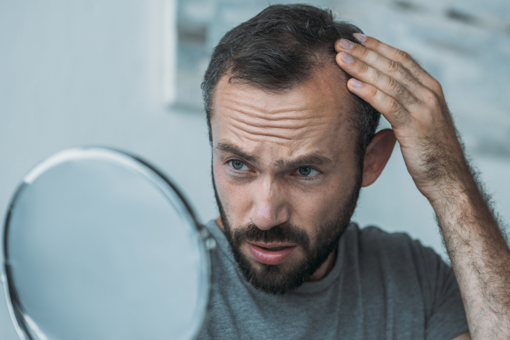 Best Hair Loss Results in Columbia