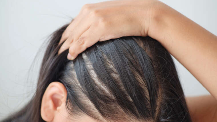 HydraFacial Keravive Hair Growth Specialist