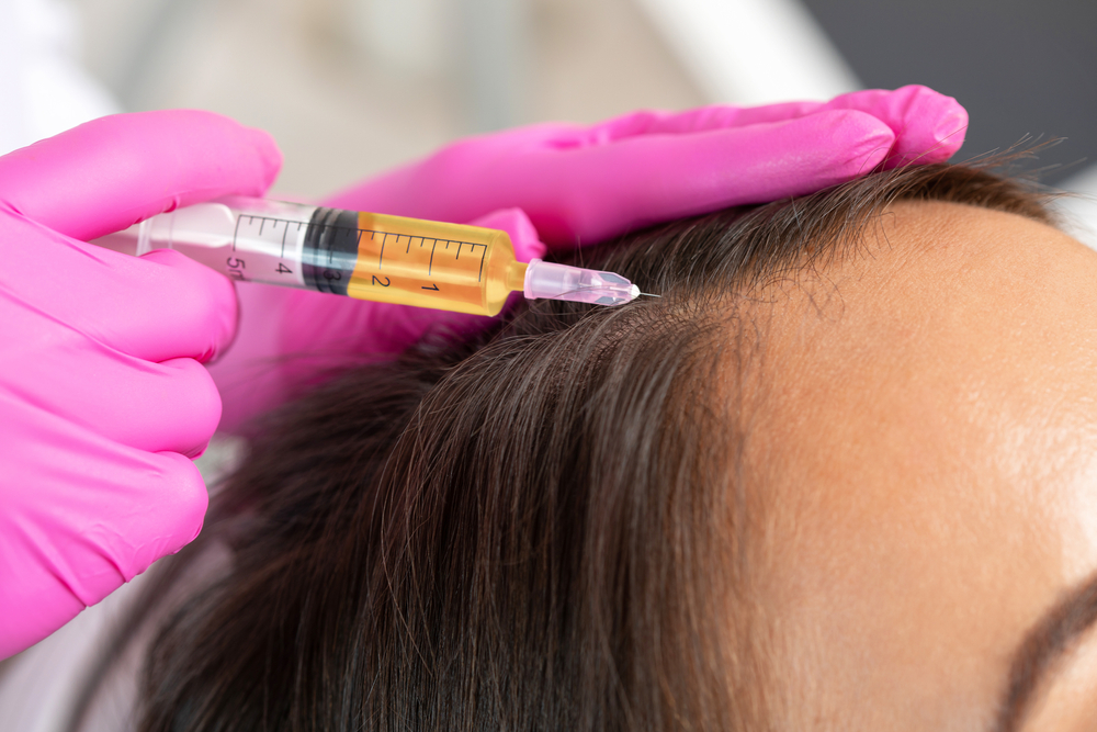 Does PRP Really Help Hair Growth?