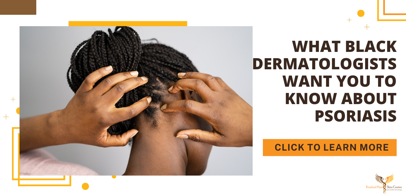 What Black Dermatologists Want You to Know About Psoriasis