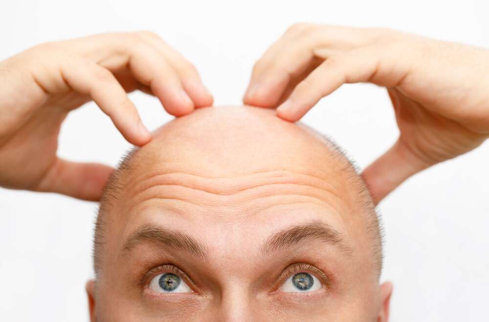 Budgeting for Hair Transplant Cost in Ellicott City, Maryland