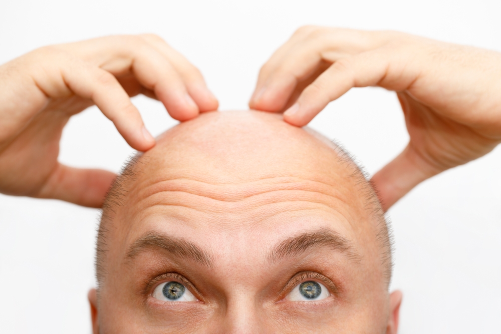 Budgeting for Hair Transplant Cost in Ellicott City
