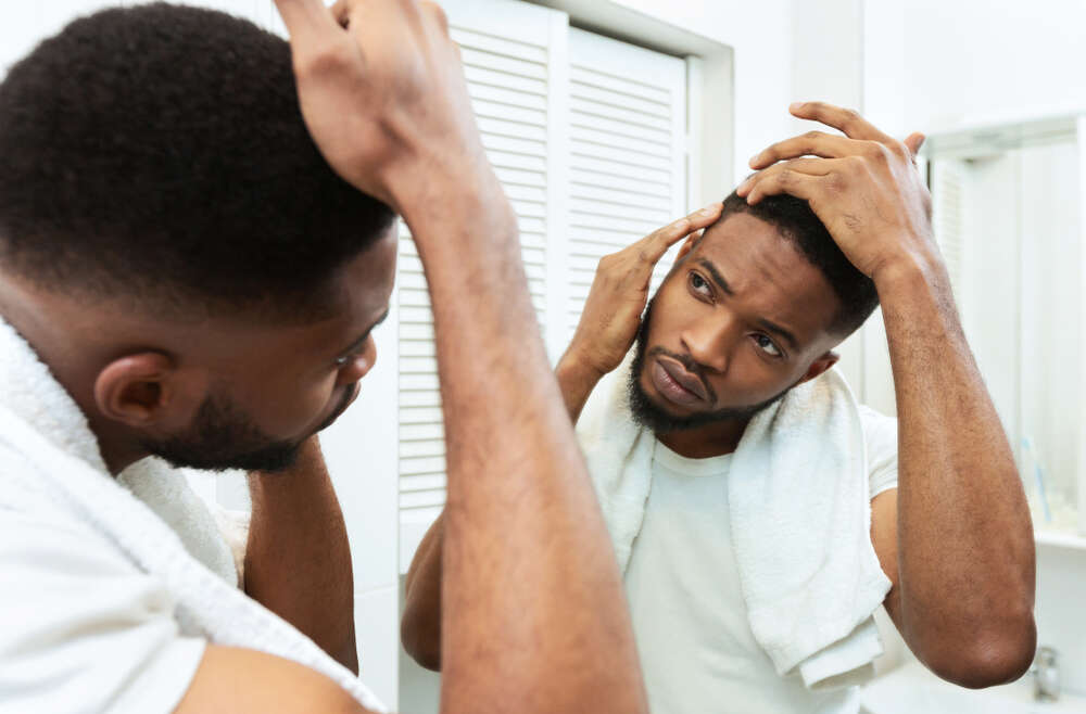 Here’s Why You Should Go to the Dermatologist for Hair Loss and Not a Different Specialist