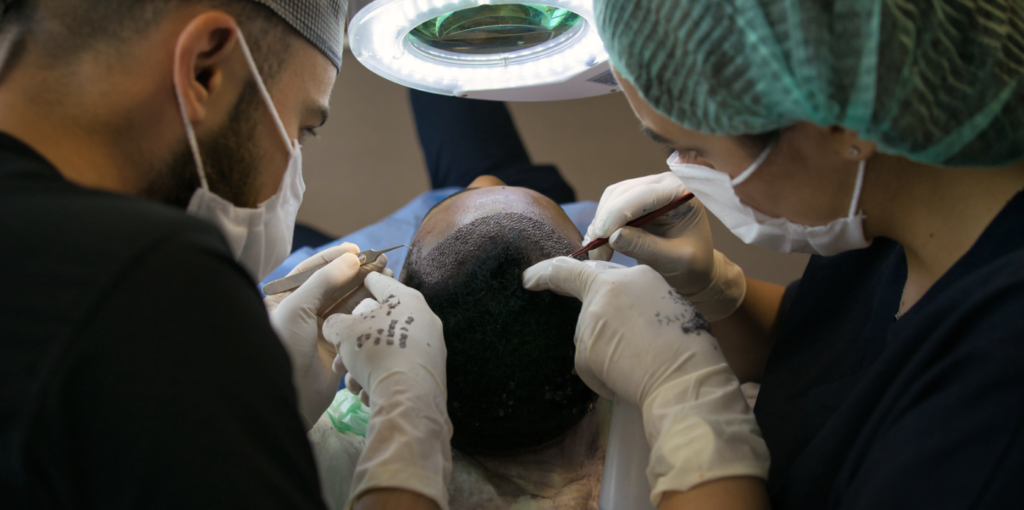 Best Hair Transplant Cost