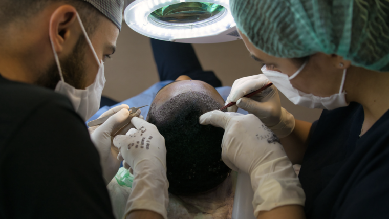 How Much Does the Best Hair Transplant Cost in Columbia?