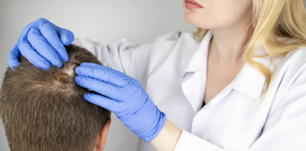 Best Alopecia Doctor