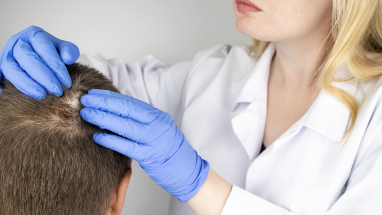 Best Alopecia Doctor in Maryland