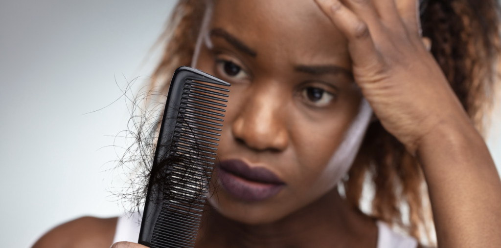 Hair Loss in Black Women