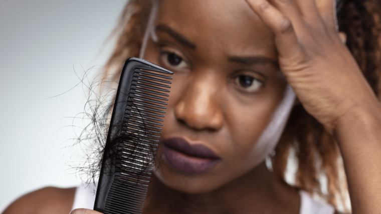 Managing Hair Loss in Black Women