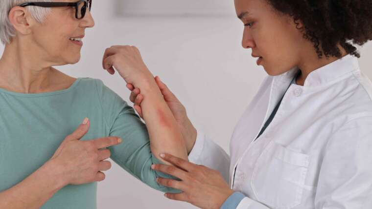 Best Atopic Dermatitis Doctor in Columbia, Maryland