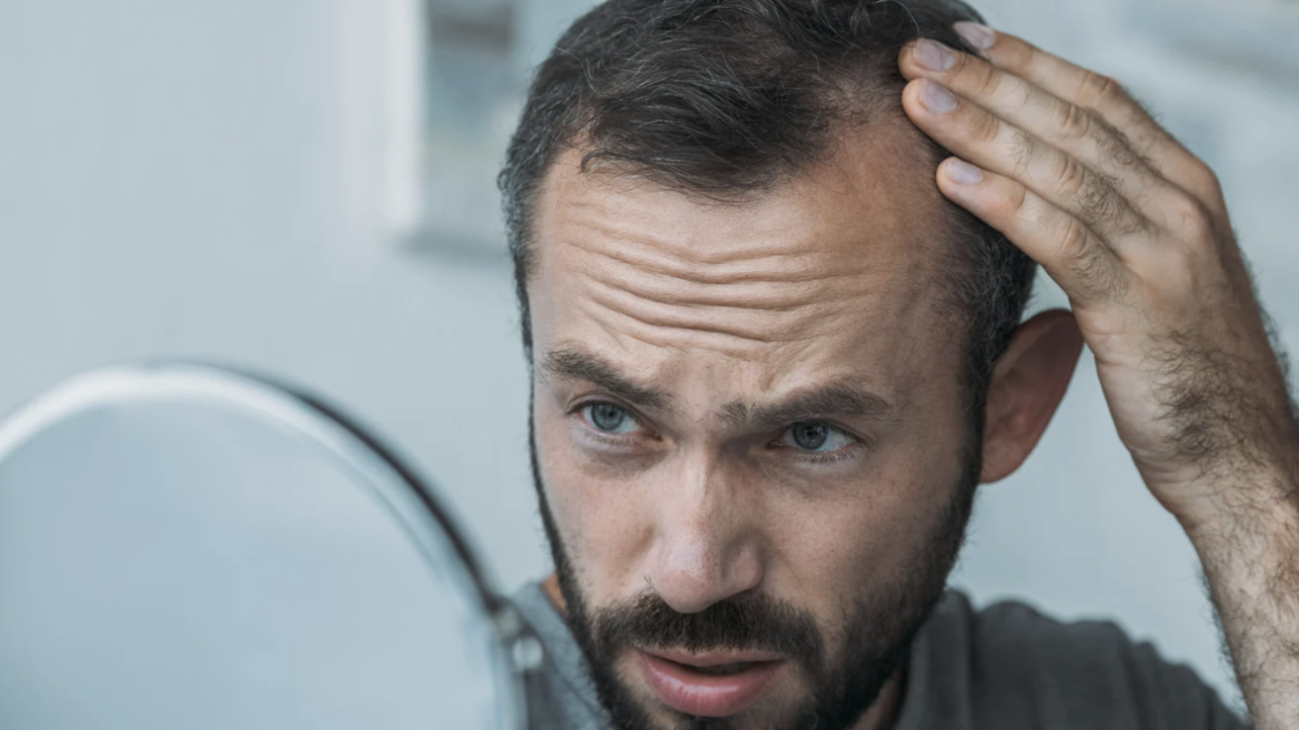 Best Alopecia Areata Doctor in Maryland