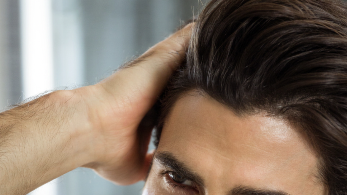 How to Choose the Best Hair Transplants