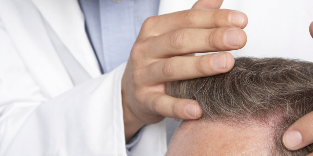 Restoring Confidence with Hair Transplant