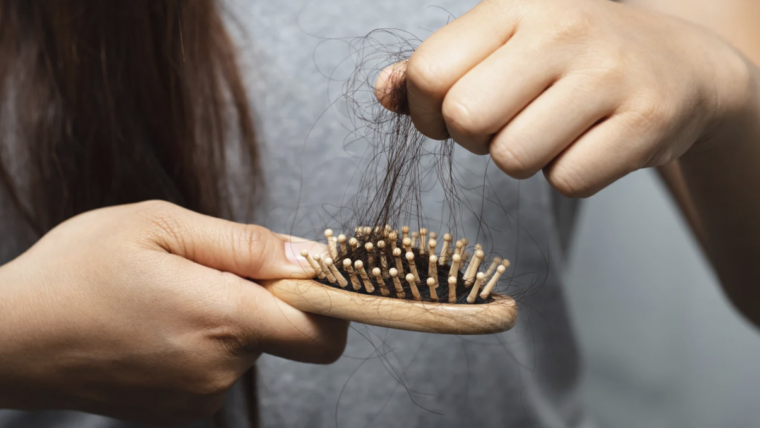 Comprehensive Hair Loss Solutions in Frederick, MD