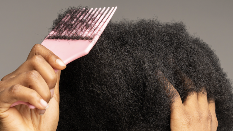 Top African-American Hair Loss Specialist in Maryland