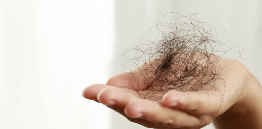 Maryland Hair Loss Doctor