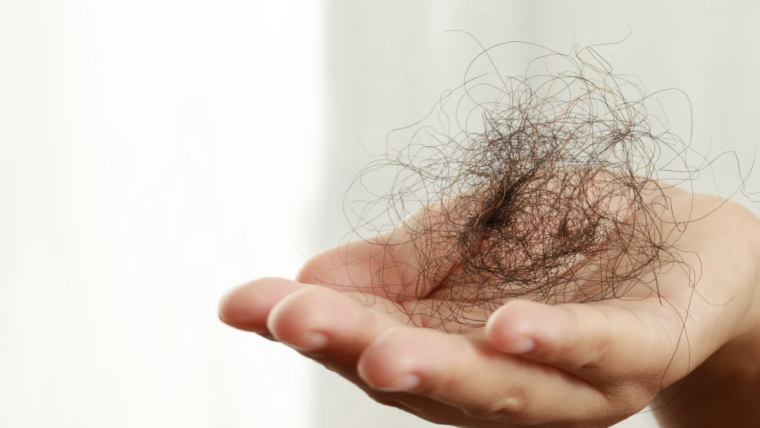 Renowned Maryland Hair Loss Doctor