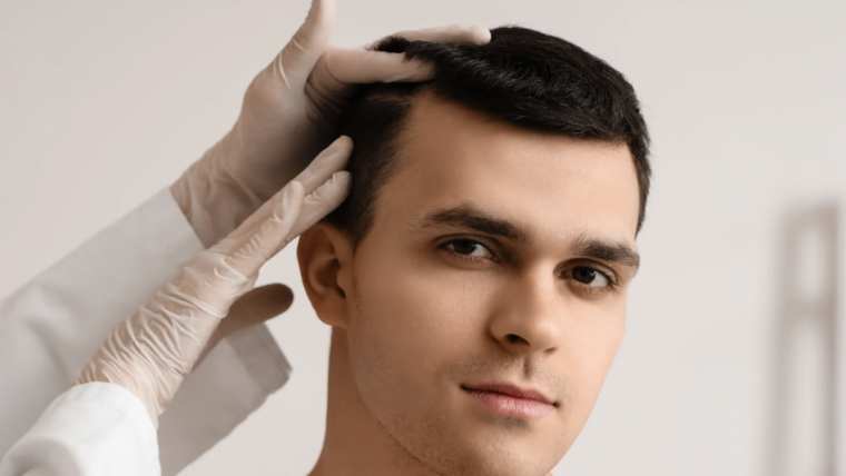FUE vs. FUT Hair Transplant Pricing in Rockville, Maryland