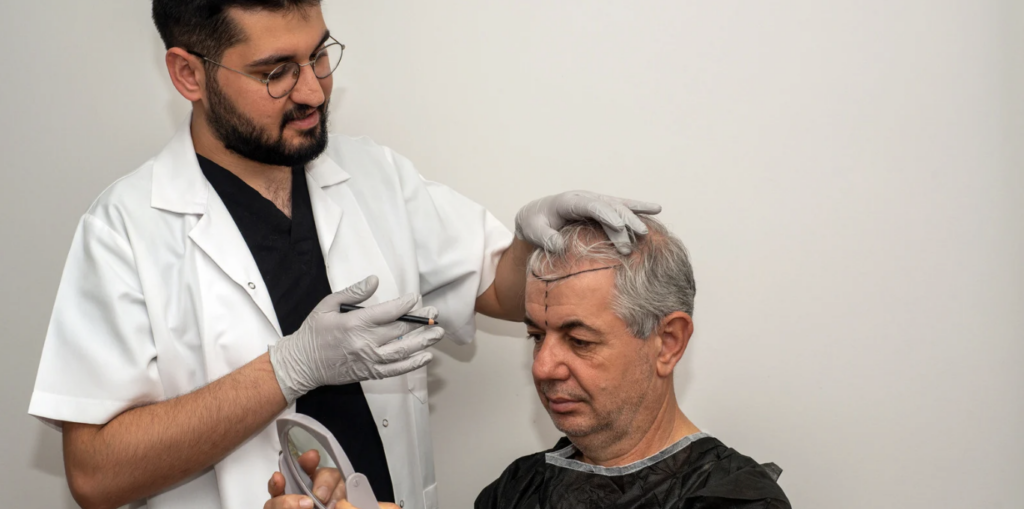 Best Provider for Hair Transplant Surgery Near Columbia Maryland