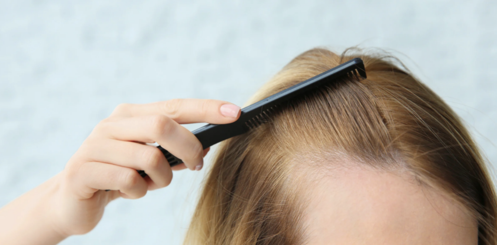 Hair Loss Dermatologist in Ellicott City Maryland