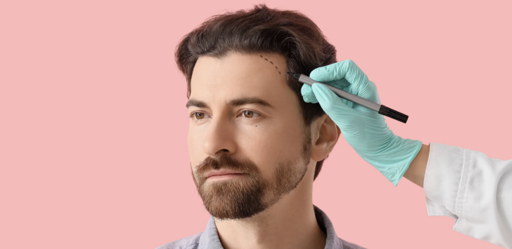 Hair Transplantation Best Results in Maryland