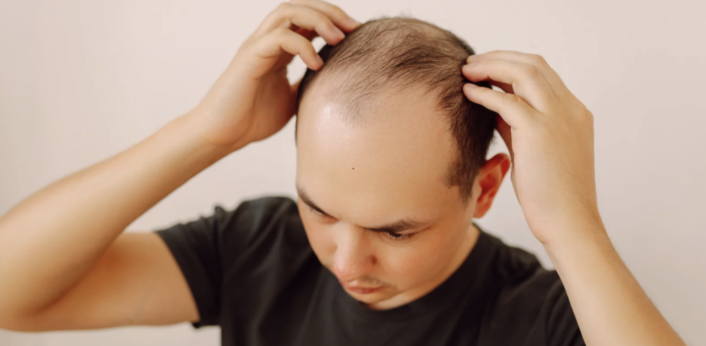 Hair Loss Specialist Appointment in Baltimore Maryland